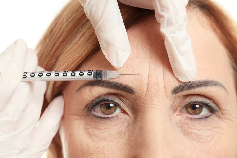 BOTOX- TOXINA BOTULÍNICA