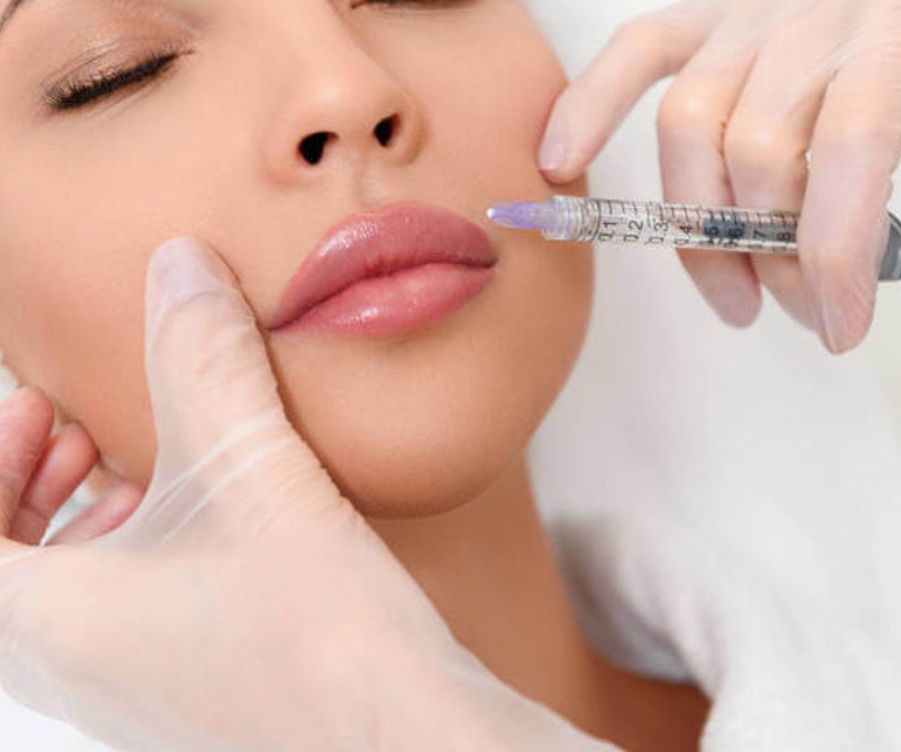 PREENCHIMENTO LABIAL