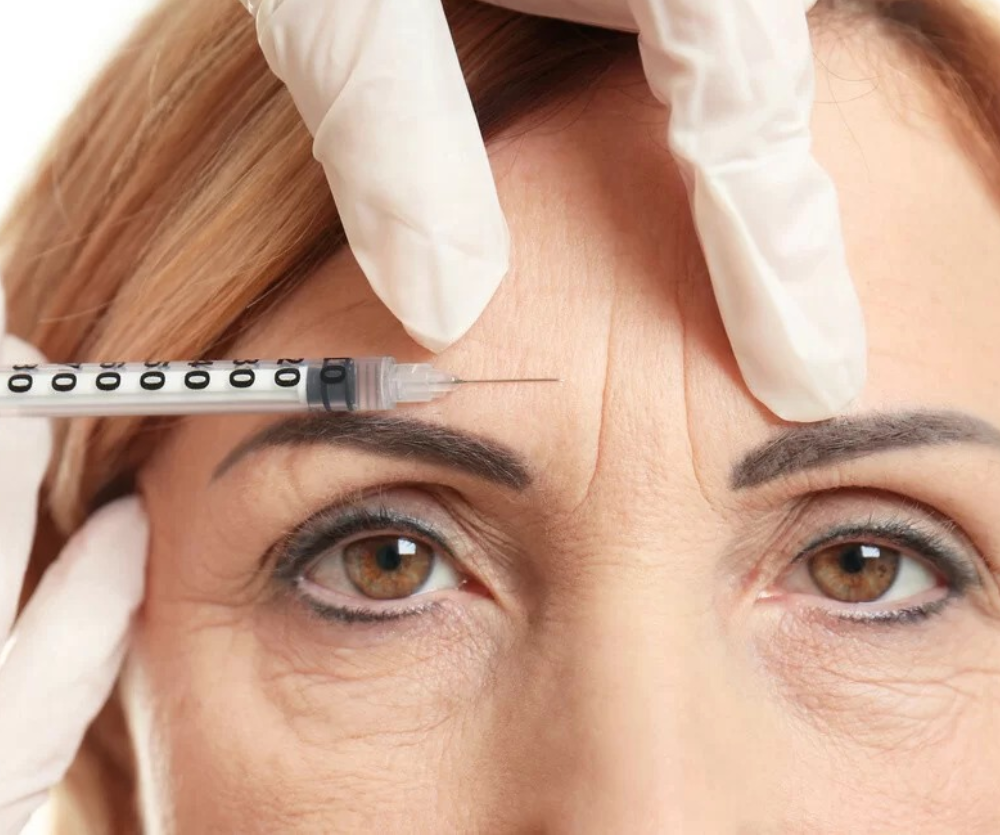 BOTOX- TOXINA BOTULÍNICA