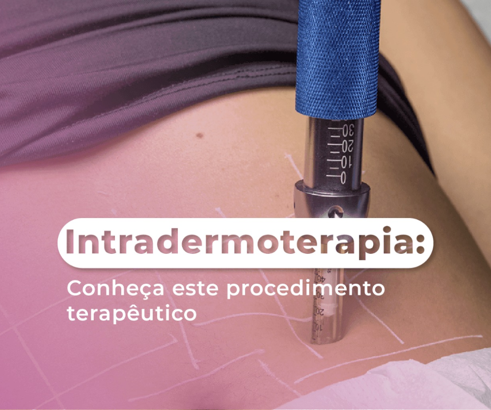 INTRADERMOTERAPIA